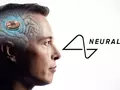 post_big/Neuralink-Brain-Implant-Medical-Device.jpg