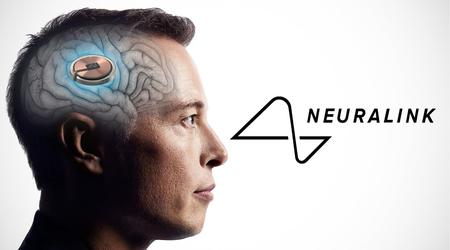 Non è morta nemmeno una scimmia - Musk sostiene la sicurezza degli impianti cerebrali Neuralink