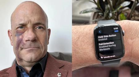 Come l'Apple Watch ha contribuito a salvare la vita di un ciclista
