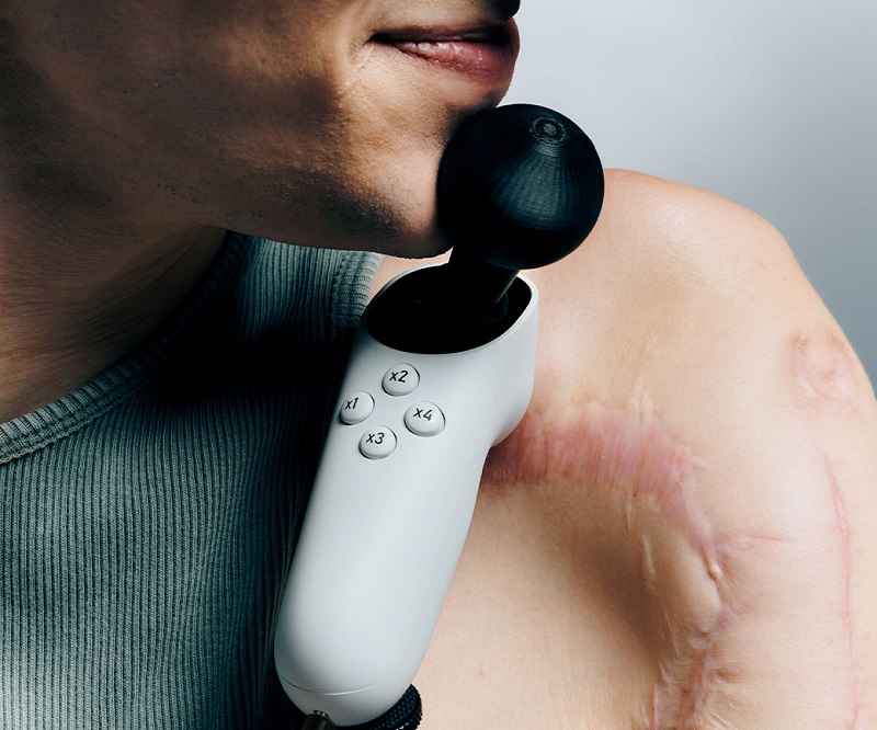 Giocare diventerà più facile: Microsoft ha presentato l'Xbox Adaptive Joystick, un dispositivo compatibile con Xbox, PC, Android e iOS, per le persone con disabilità.-2 Giocare diventerà più facile: Microsoft ha presentato l'Xbox Adaptive Joystick, un dispositivo compatibile con Xbox, PC, Android e iOS, per le persone con disabilità.-2