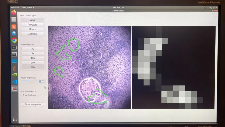 Google e il Pentagono hanno sviluppato un microscopio basato sull'intelligenza artificiale per la diagnosi del cancro-3